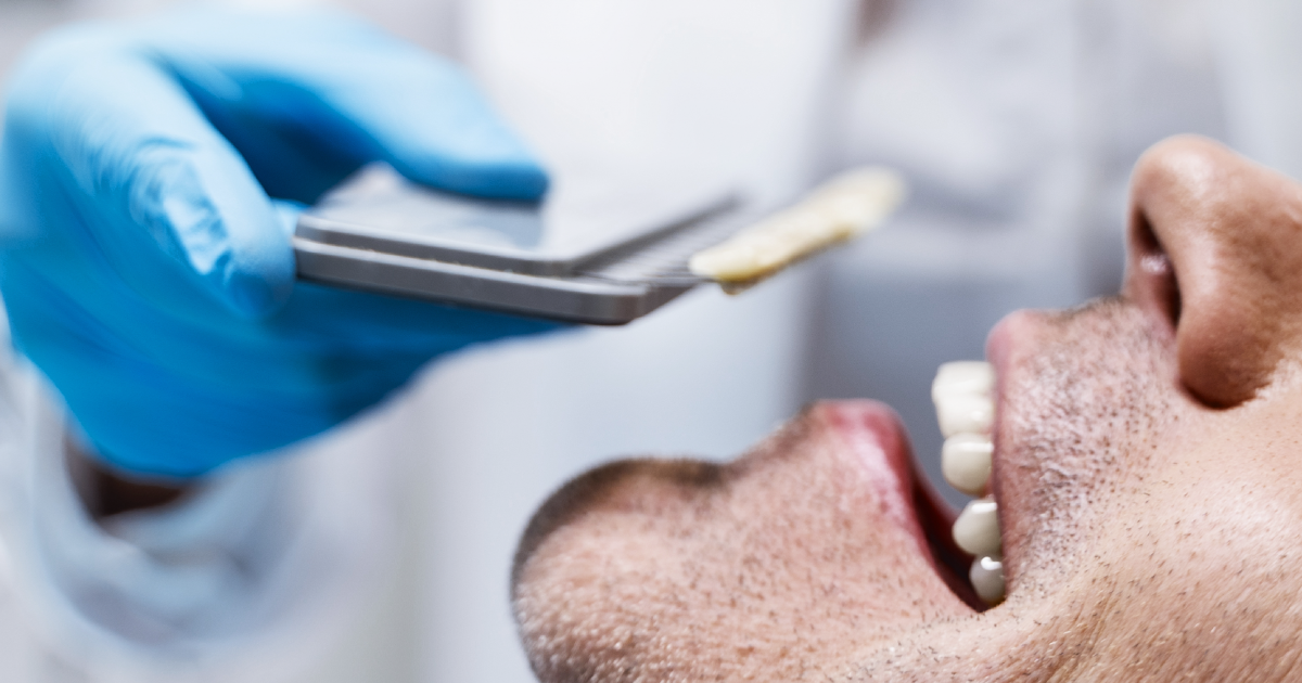 Mexican Dental Implants Your Top Choice